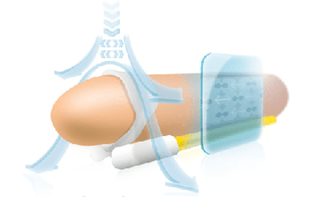 The principle of operation of the expander to stretch the phallus in length